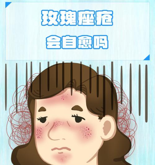 小玫瑰花在脸上代表的含义是什么？